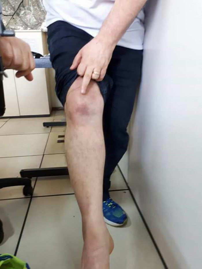 Ex-governador Anthony Garotinho mostra supostas agress&otilde;es sofridas dentro de cela em cadeia p&uacute;blica em Benfica