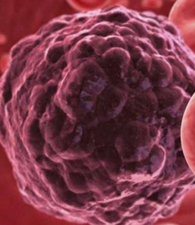 Células cancerígenas - câncer - saúde - Banco de imagens