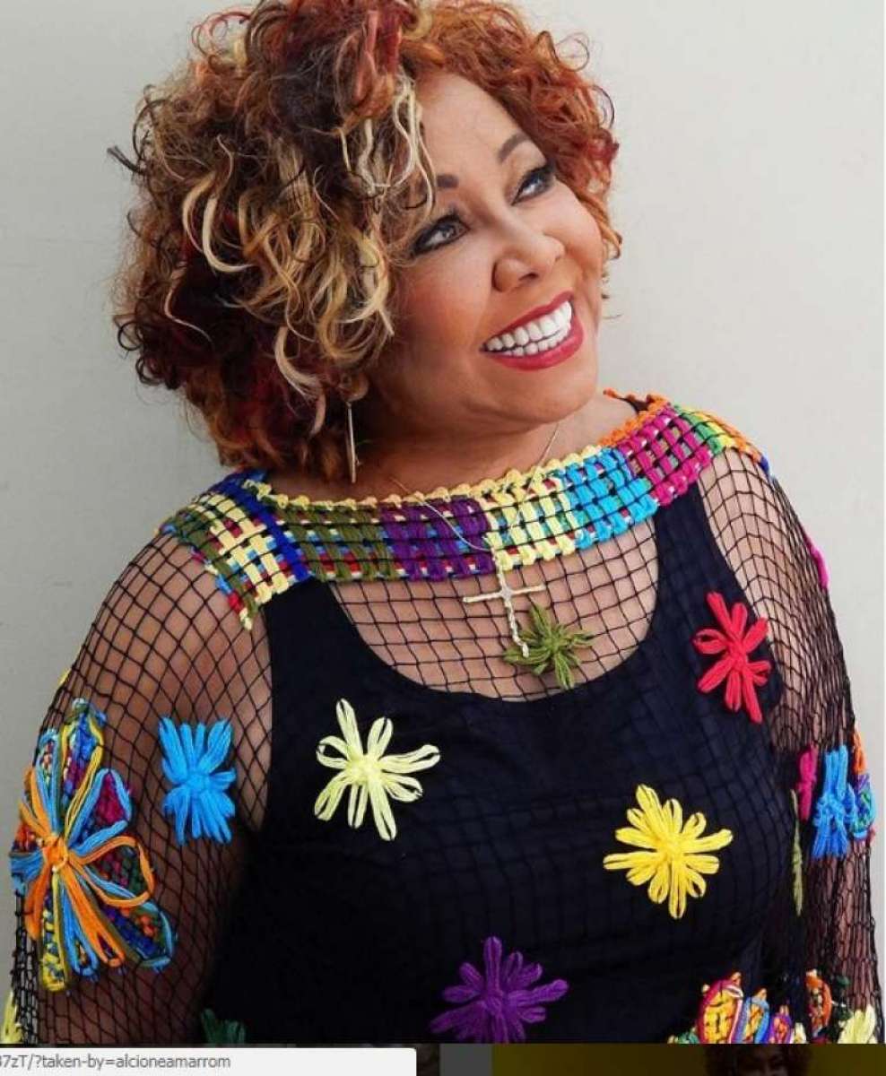 Alcione passa por cirurgia