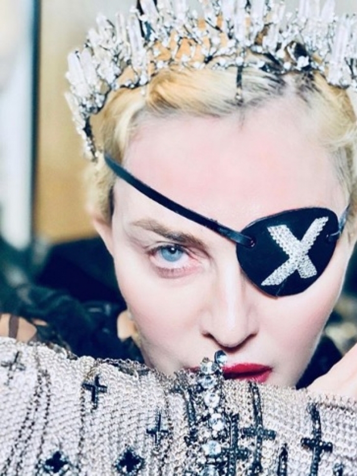 Madonna causou na apresentação do Eurovision