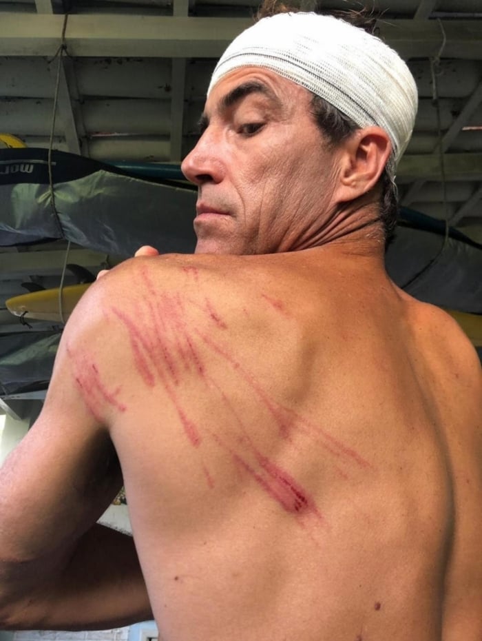 Surfista Carlos Burle se machuca na Baia de Guanabara