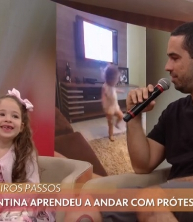 Pai faz tatuagem em forma de prótese para homenagear a filha