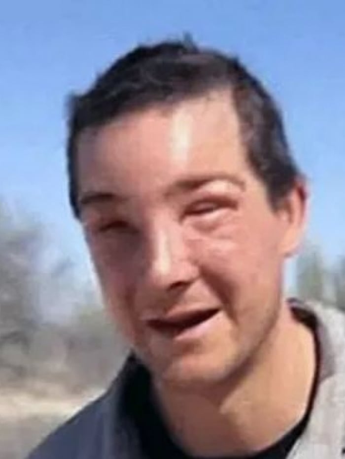 Esta é a segunda vez que Bear Grylls quase morreu em reality após picada de abelha