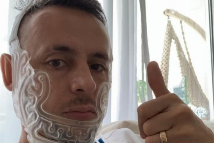 Rafinha aparece usando capacete estilo Petr Cech