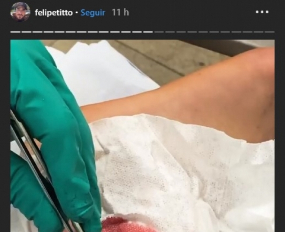 Felipe Titto leva mordida de seu cachorro no momento em que vai pular na piscina