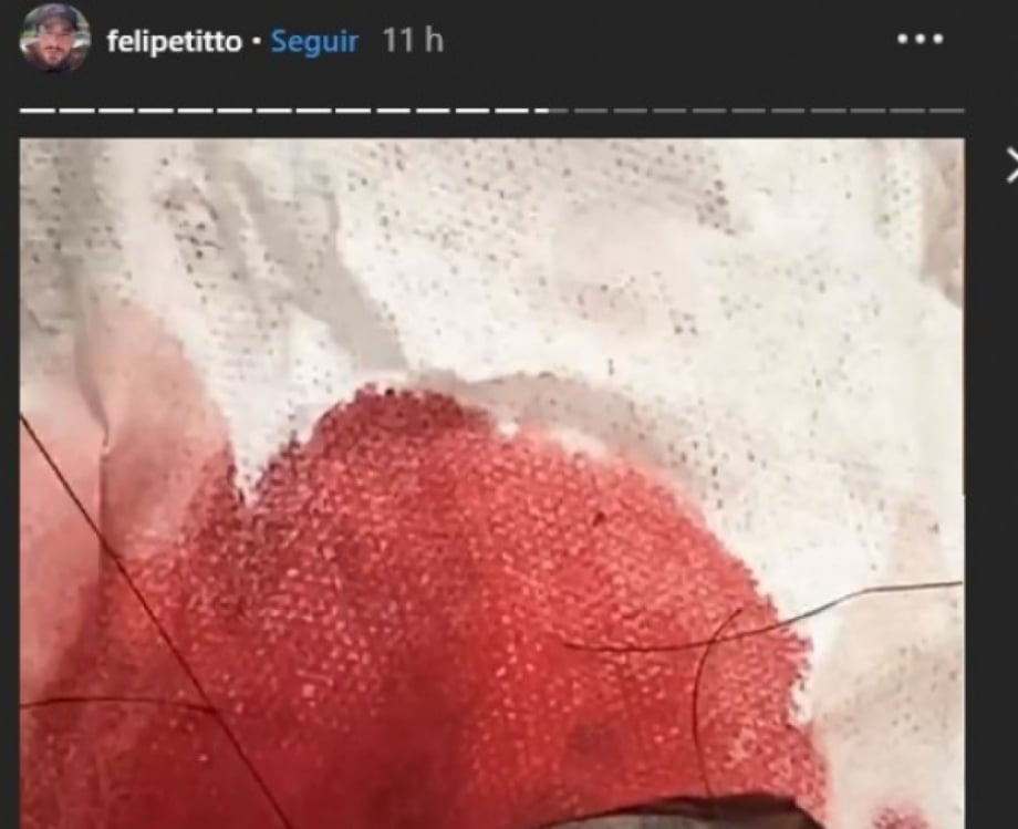 Felipe Titto leva mordida de seu cachorro no momento em que vai pular na piscina