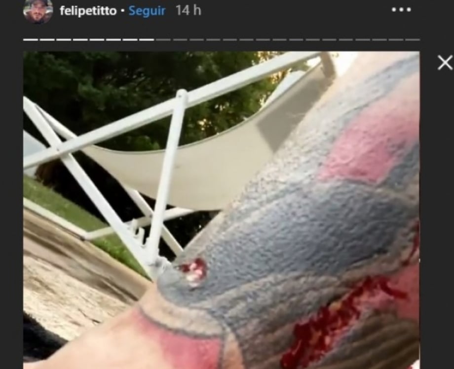 Felipe Titto leva mordida de seu cachorro no momento em que vai pular na piscina