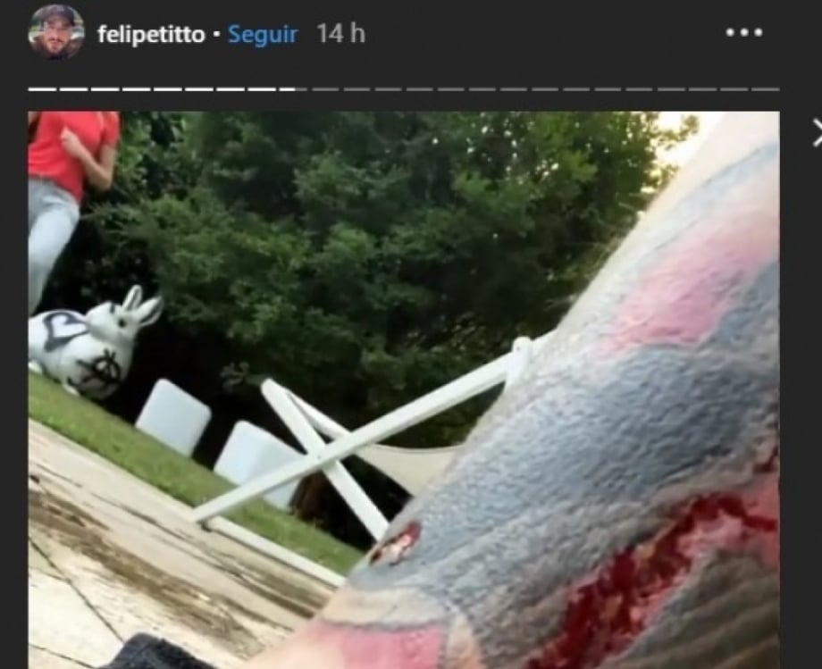 Felipe Titto leva mordida de seu cachorro no momento em que vai pular na piscina