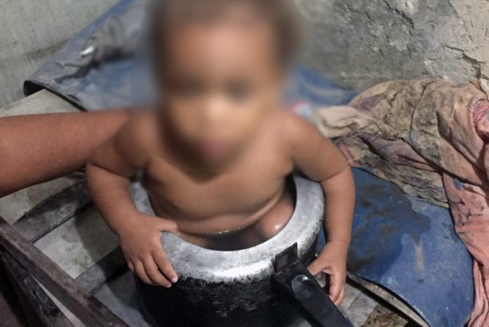 Criança estava brincando quando entrou na panela de pressão
