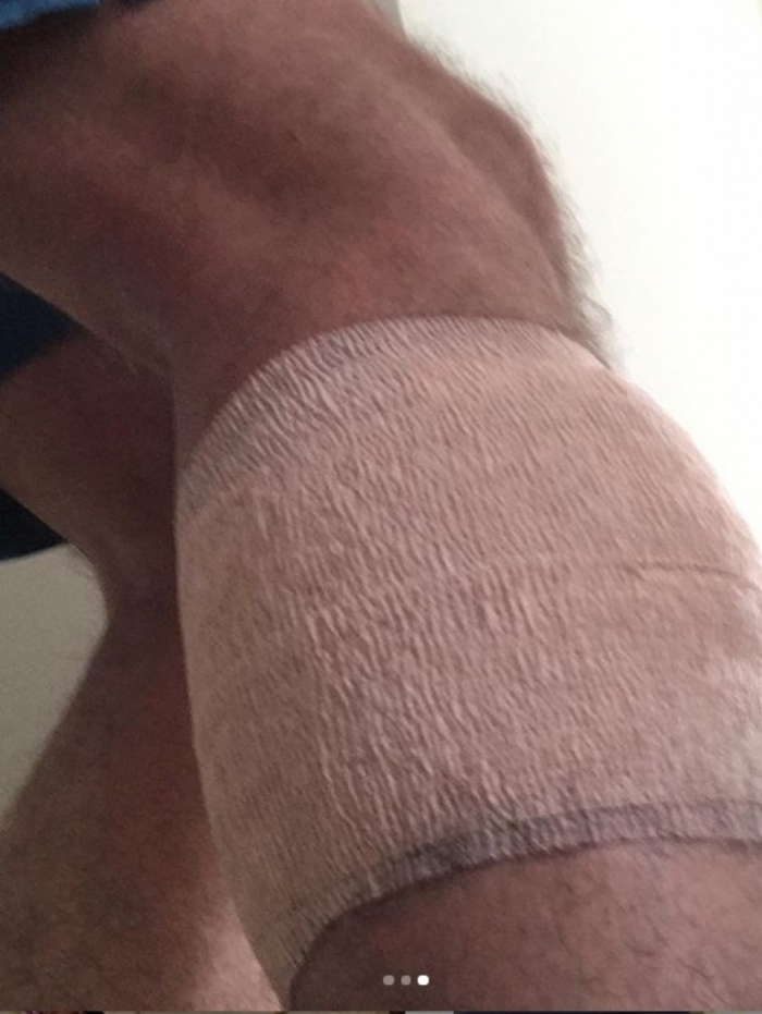 Alex Escobar fere a perna 