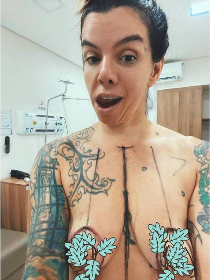 Apresentadora mostrou resultado de cirurgia pelo Instagram
