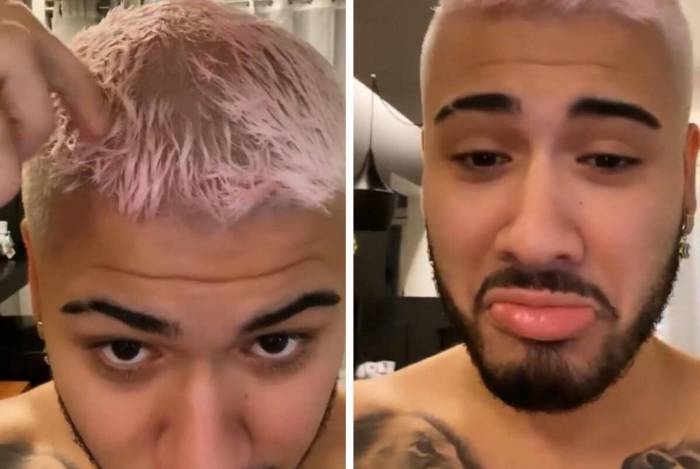 Kevinho tenta descolorir cabelo em casa e fica com buraco no couro cabeludo