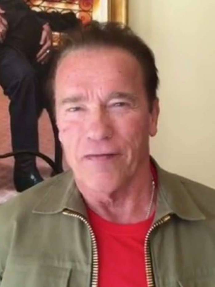 Arnold schwarzenegger passa por cirurgia