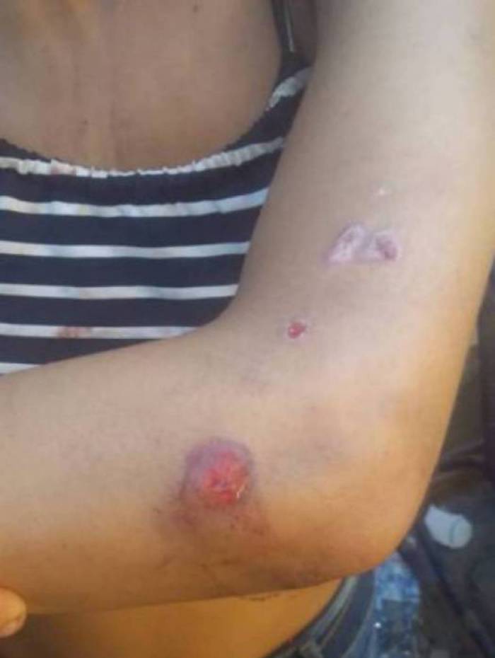 Jovem foi agredida pelo namorado da irmã em Nova Iguaçu, na Baixada Fluminense 