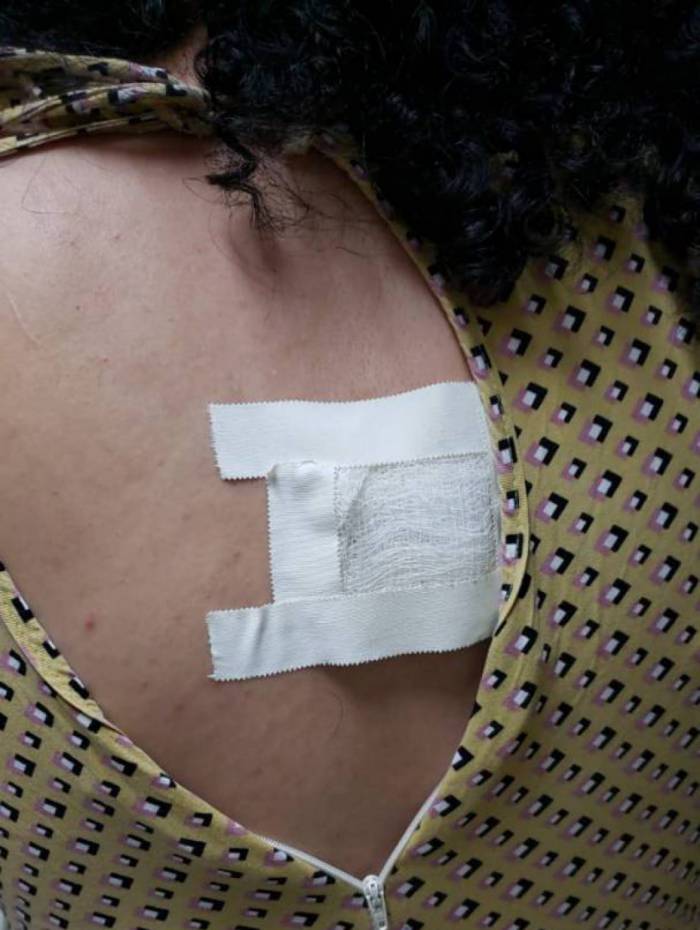 Vítima ficou com várias marcas das agressões