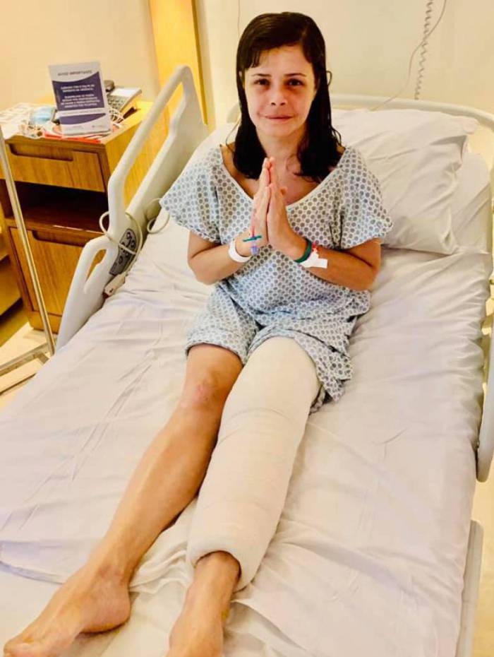 Ticyana D'Azambuja passou por cirurgia para colocar parafusos no joelho. Ela sofreu fraturas ap&oacute;s ser agredida por reclamar de festa durante isolamento social