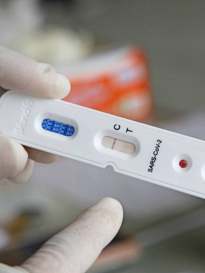 Atualiza&ccedil;&atilde;o Covid-19 em Teres&oacute;polis