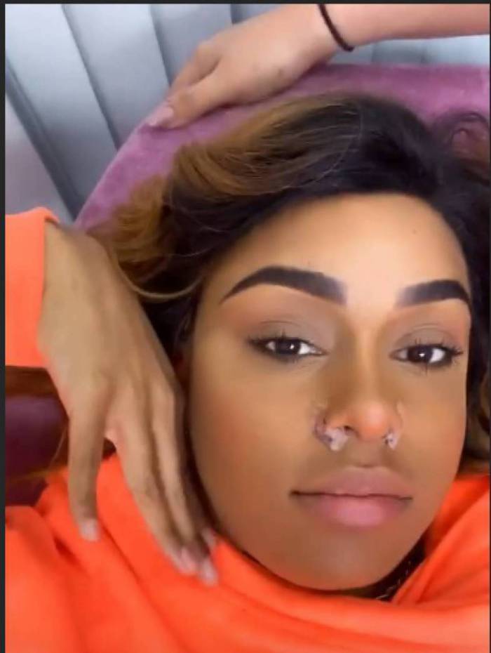 mc rebecca faz cirurgia no nariz