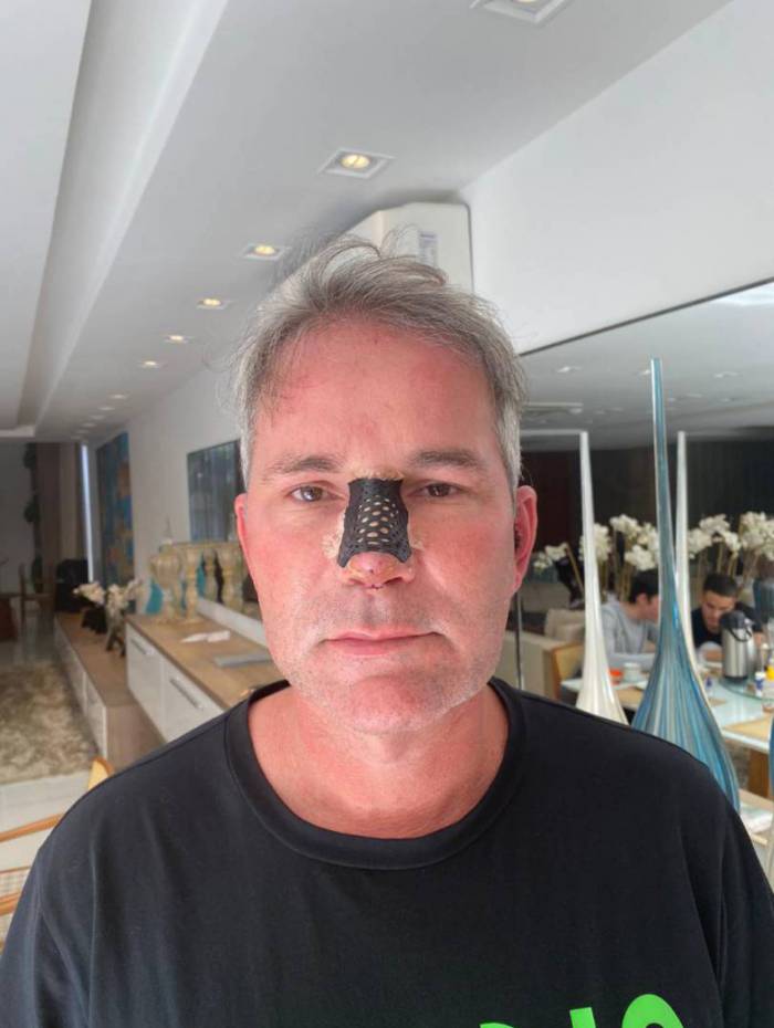 M&aacute;rcio Poncio 