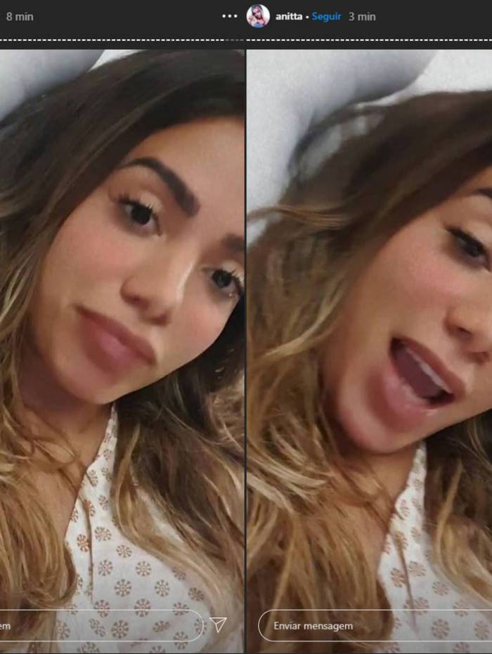 Anitta foi diagnosticada com trombose