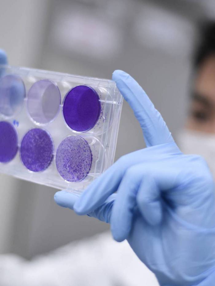 Fase 3 do estudo da Johnson &amp; Johnson come&ccedil;ou a recrutar volunt&aacute;rios no final de setembro