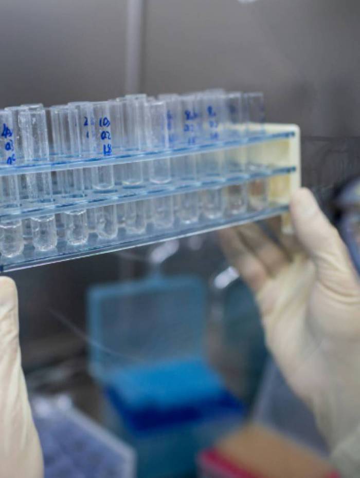 Anvisa avalia estudos n&atilde;o cl&iacute;nicos de vacina contra a covid-19