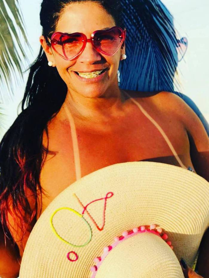 MC Atrevida fez lipoescultura