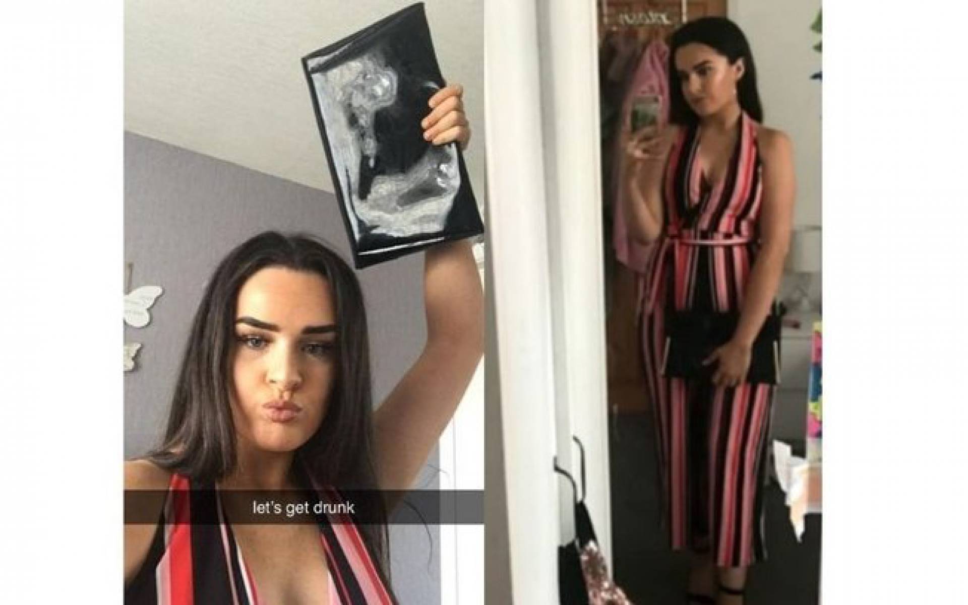 Bolsa de Siobhann Mulvey foi confundida com ultrassom
