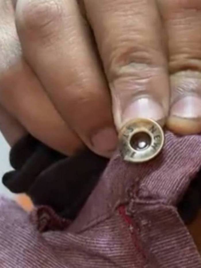 Motorista da van mostra o bot&atilde;o da bermuda que salvou sua vida