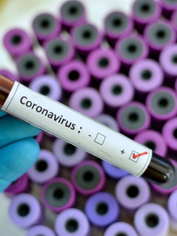 Entre os casos confirmados, 228.996 pacientes se recuperaram da doen&ccedil;a