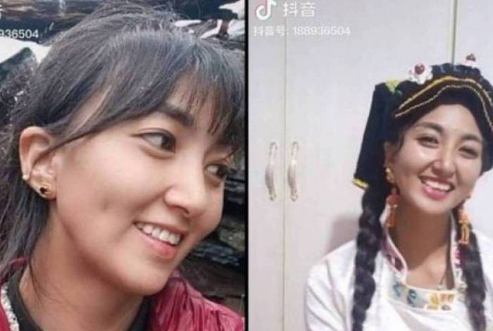 Homem não supera término e ateia fogo na ex-mulher durante transmissão ao vivo