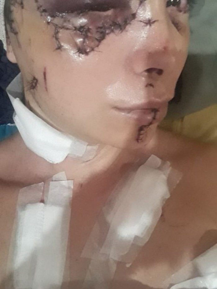 Rebekka precisou levar 100 pontos por causa das facadas