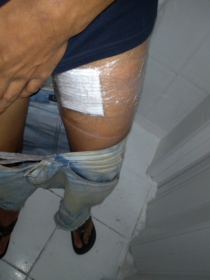 Gustavo guardou notas em um papel e fez um falso curativo