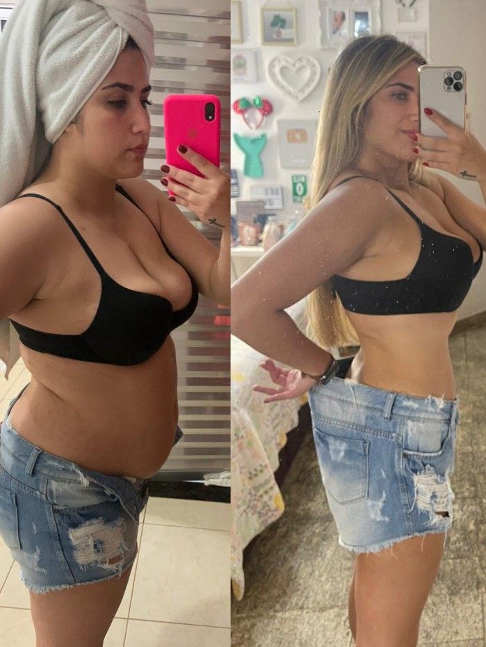 Jessica Costa perdeu mais de 20 kg ap&oacute;s passar por cirurgia 