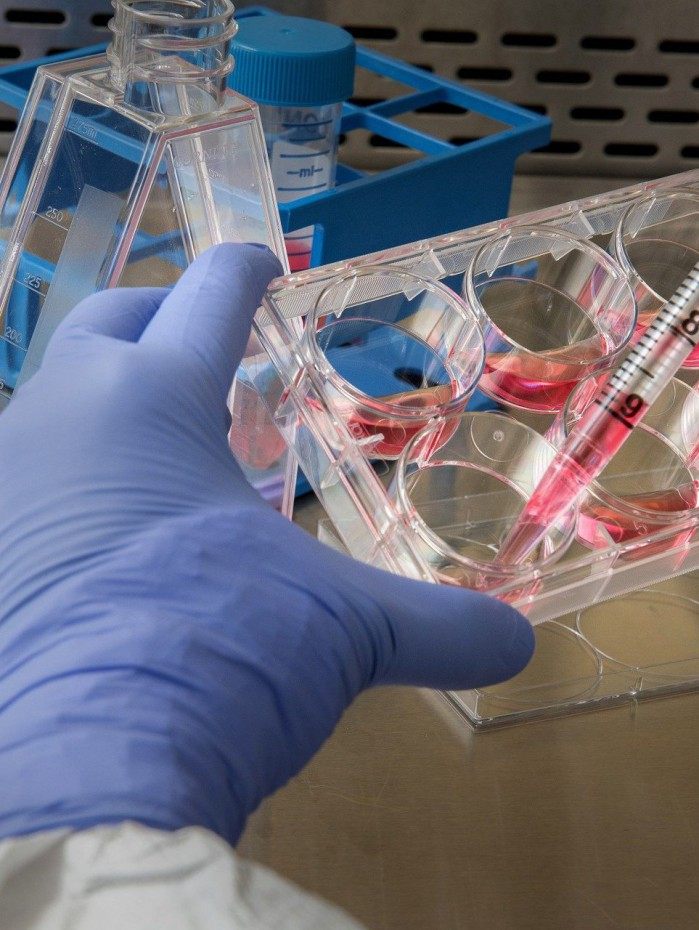 Aumento de casos fez procura por exames RT-PCR explodir