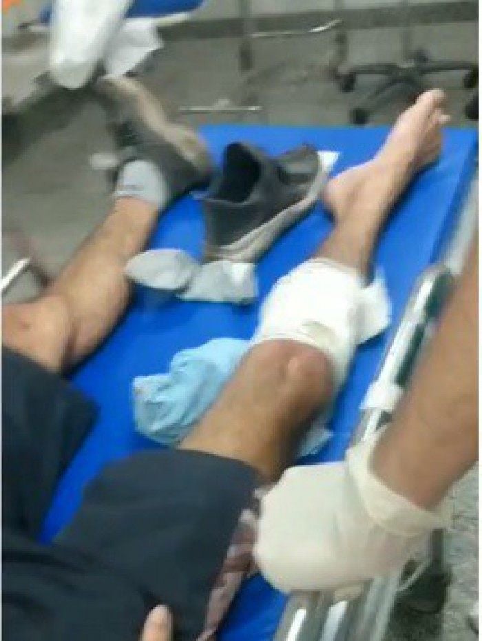 O entregador Felipe Braga, 25 anos, foi baleado na perna e socorrido para o Hospital Salgado Filho