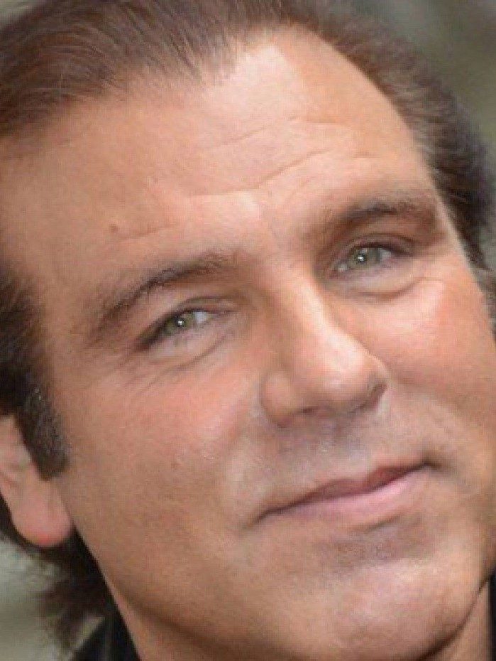 Al&eacute;m de ter perdido seus "poderes", Amdur alegou que sua vida sexual foi arruinada ap&oacute;s a batida de carro, que o causou problemas de ere&ccedil;&atilde;o