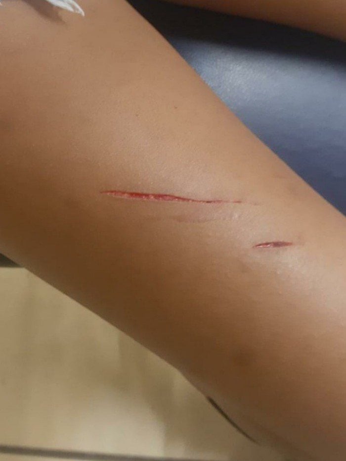 V&iacute;tima foi agredida com golpes de estilete