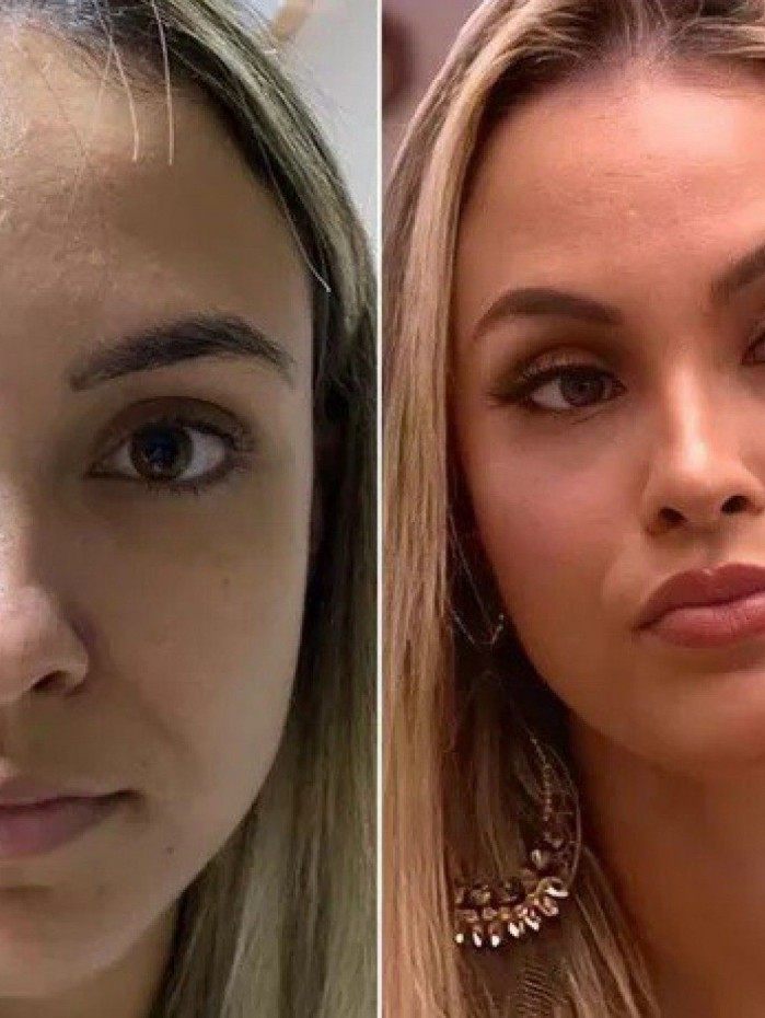 Sarah fez harmoniza&ccedil;&atilde;o facial antes de entrar no 'BBB 21'