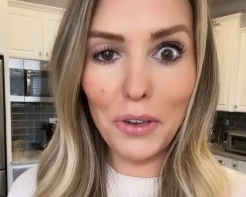 Influencer tem rea&ccedil;&atilde;o a botox e fica com olho arregalado