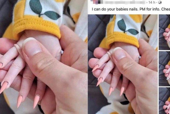 Prints da publicação foram parar no Reddit, rede social muito usada no exterior, e diversas pessoas ficaram chocadas com as unhas da bebê