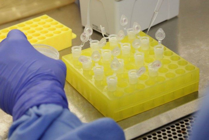 Testes para vacina contra HIV têm resultados promissores