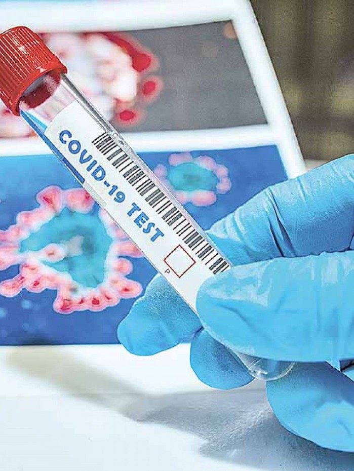 Cientistas descobrem novo coronav&iacute;rus em morcegos brasileiros com tra&ccedil;o similar ao da Covid