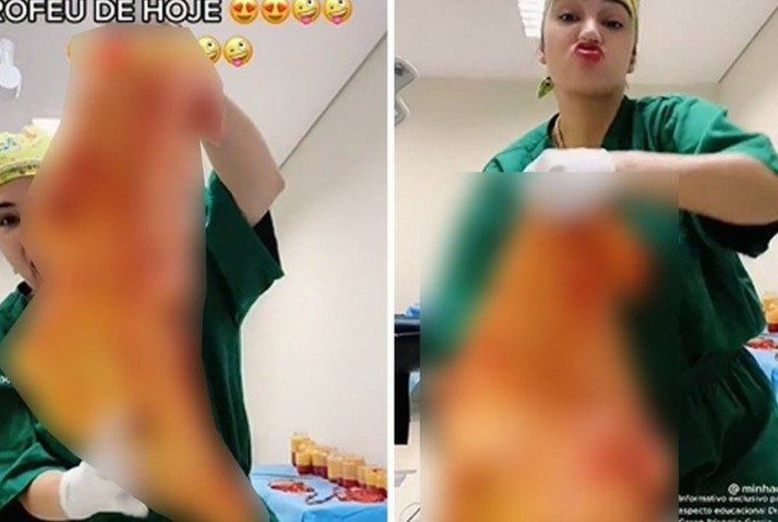 A cirurgiã Caren Trisoglio Garcia postou vídeos de pele de pacientes nas redes sociais
