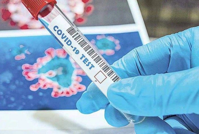 Prefeitura de Volta Redonda faz mais de 80 testes de antígeno para diagnóstico da Covid-19 neste sábado, dia 10