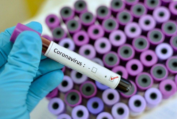Boletim coronavírus deste domingo, dia 25, em Volta Redonda