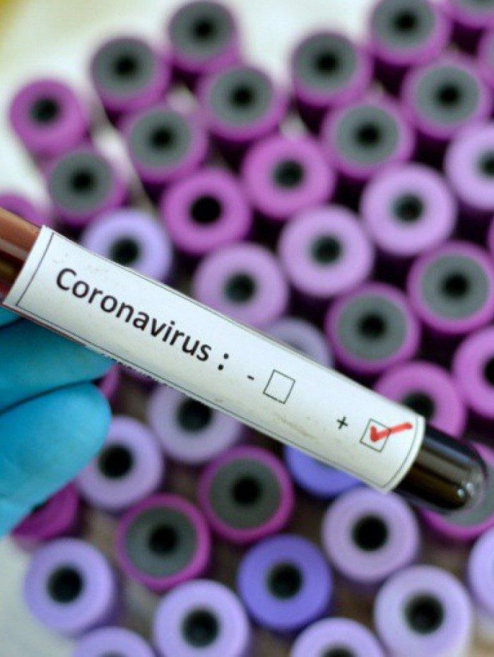 Rio confirma terceiro caso da variante &ocirc;micron no munic&iacute;pio