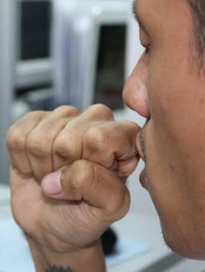 Sa&uacute;de alerta para aumento de casos de coqueluche no pa&iacute;s