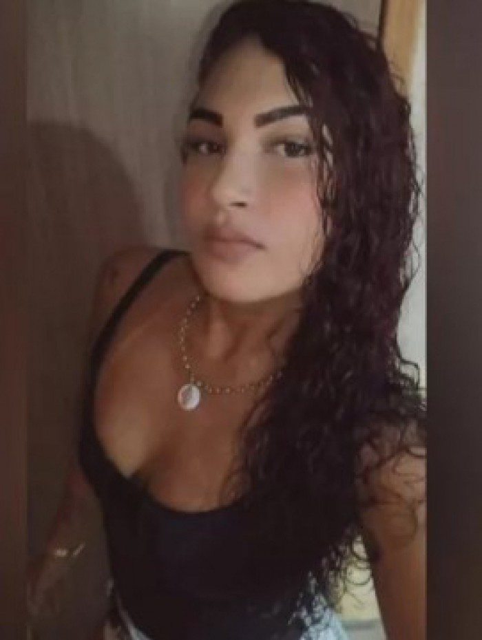 Mulher &eacute; baleada na cabe&ccedil;a durante briga com o namorado na Baixada Fluminense