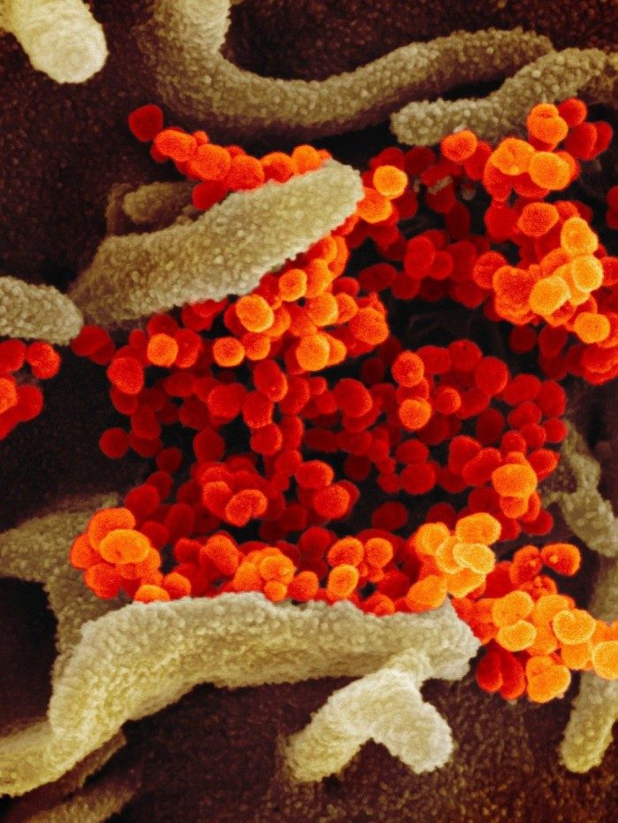 No momento, existem 52 doentes hospitalizados na Rede Pública Municipal, enquanto outros 4.967 se recuperam em quarentena domiciliar